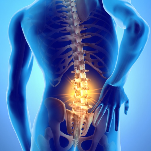 Sciatica/Disc Herniation's