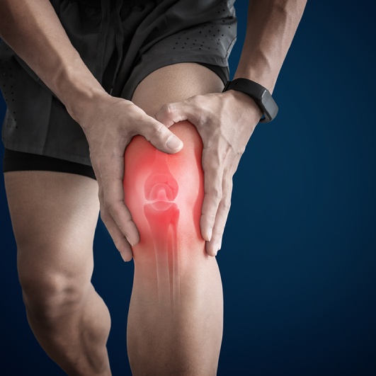 Arthritis