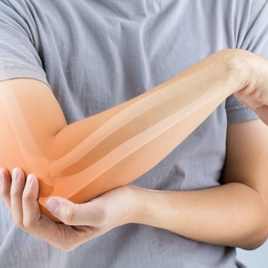 Fractures, Sprains/strains